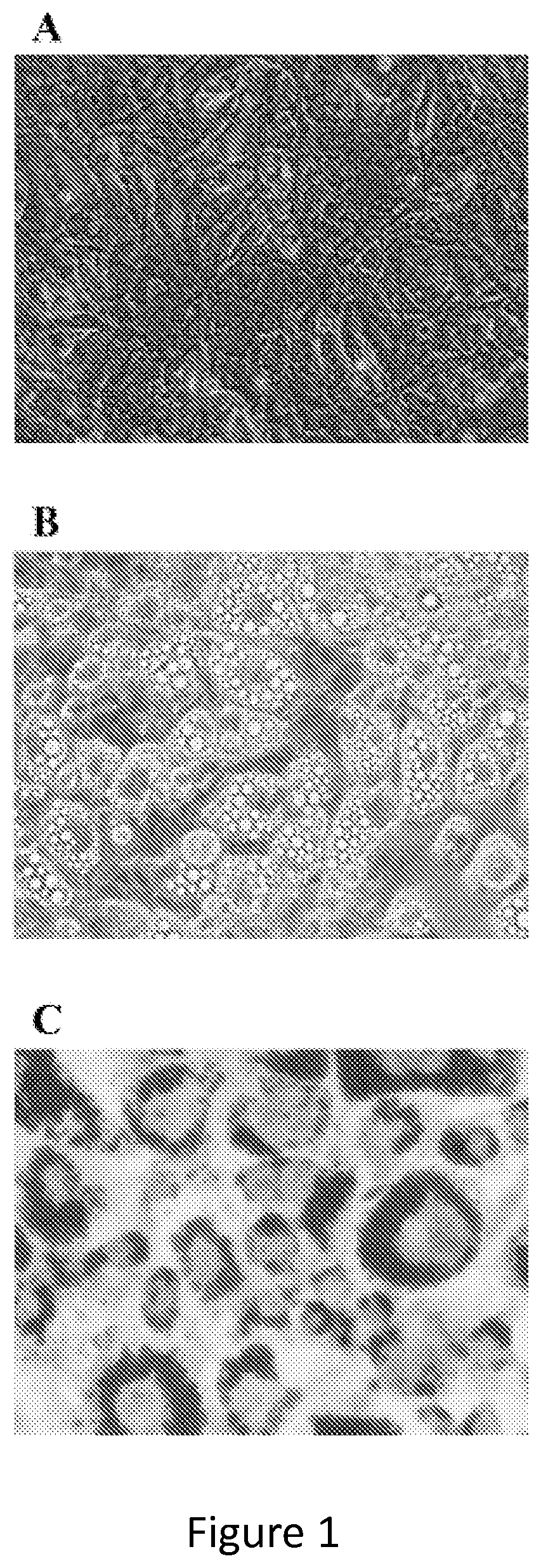 Methods and compositions of bile acids and salts for reduction of fat