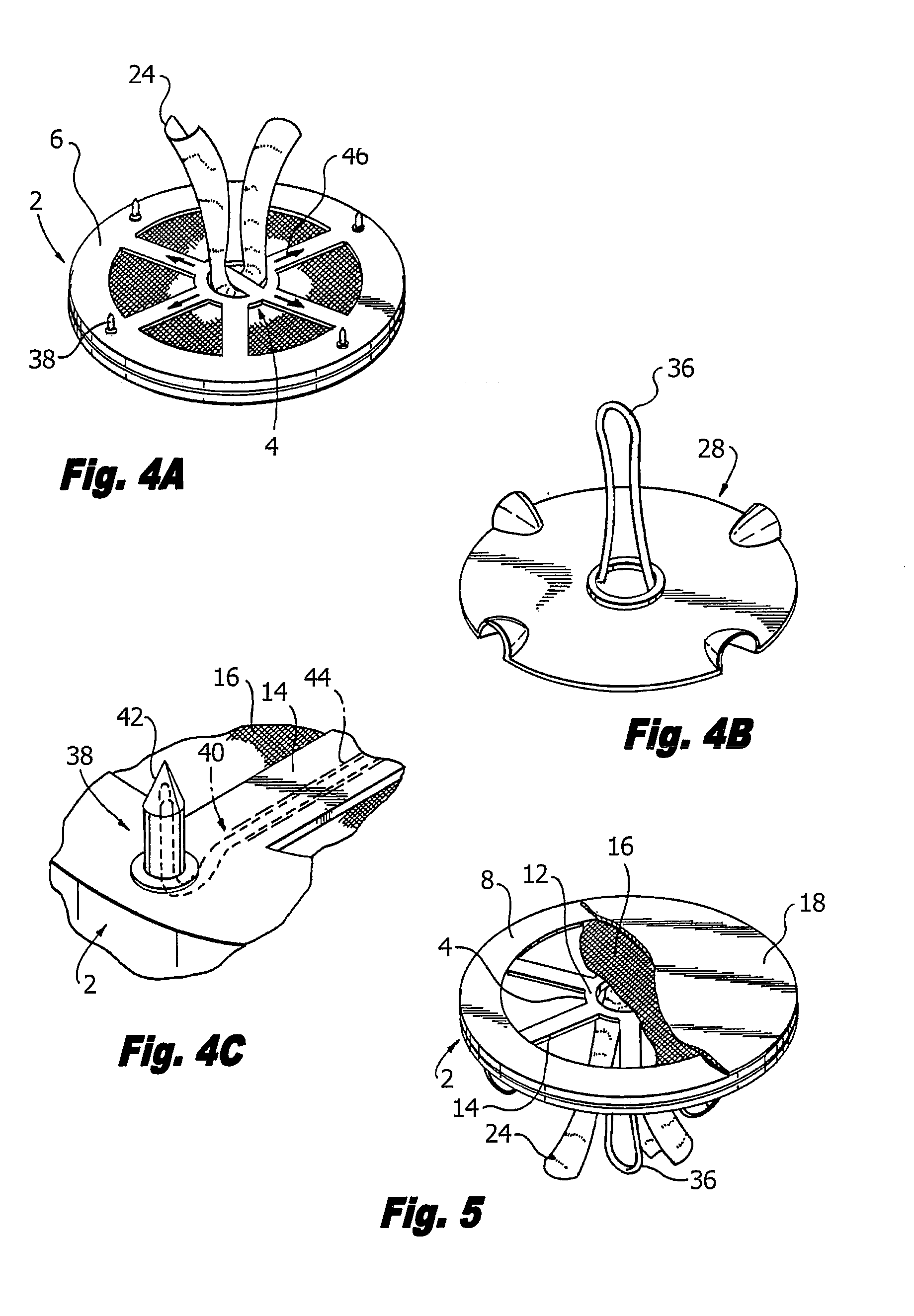 Methods of repairing a hernia using a hernia support device