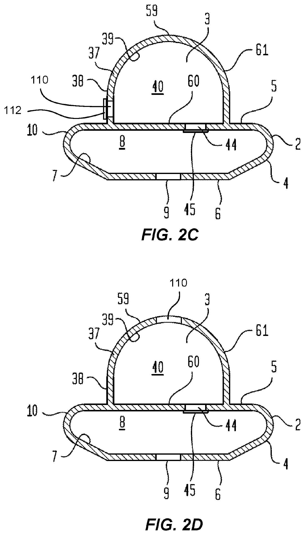 Ear pumps