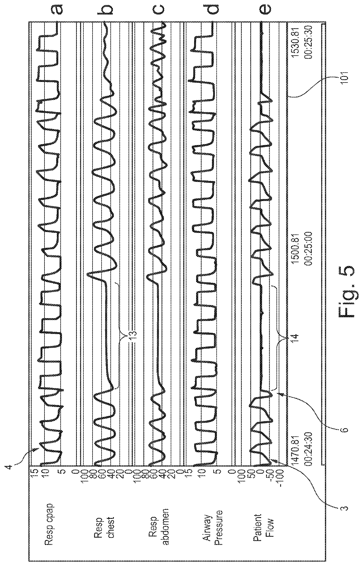 Ventilation system comprising at least one ventilator and at least one diagnosis device and method of operating