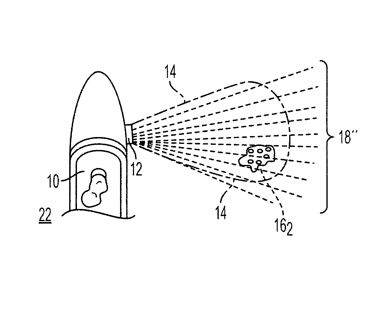 Apparatus and method for compensating images for differences in aspect