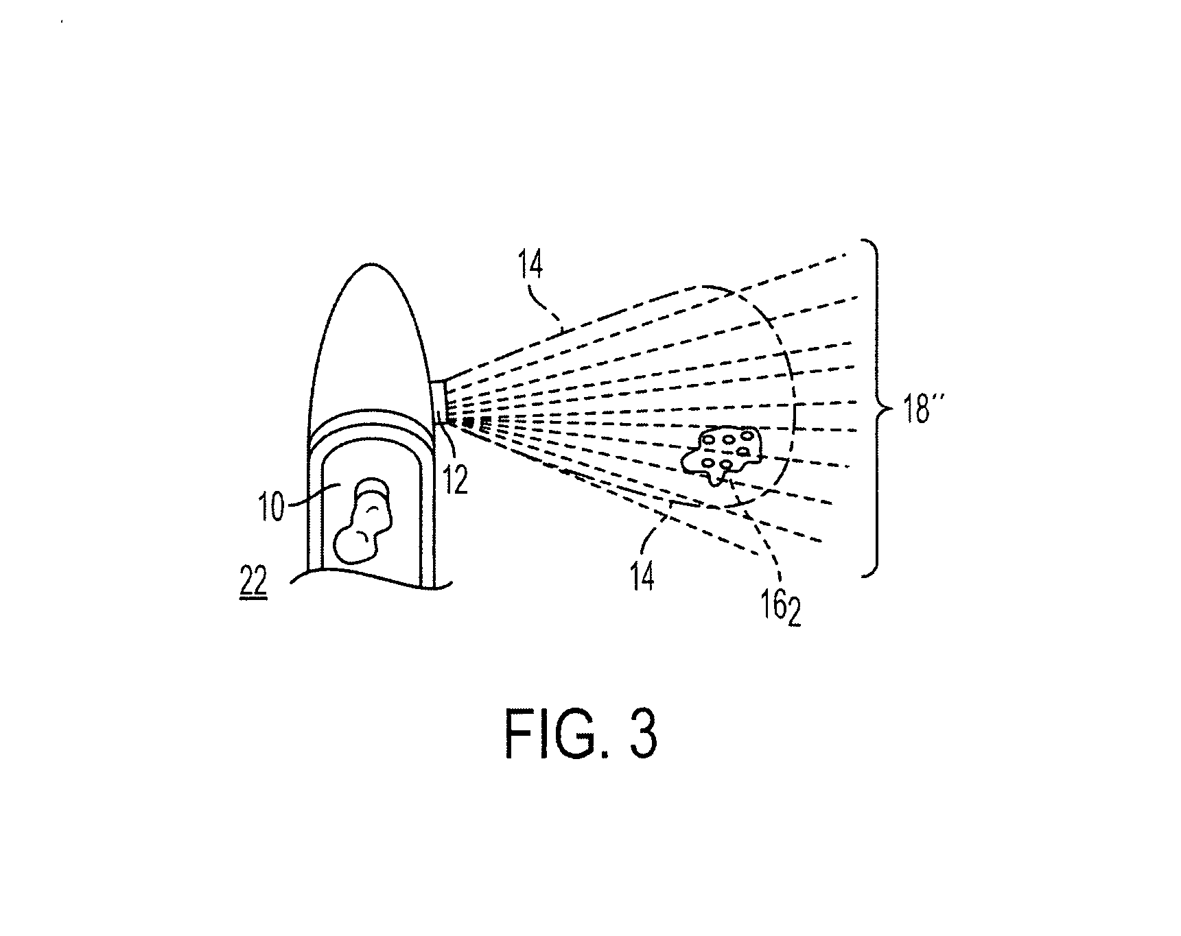 Apparatus and method for compensating images for differences in aspect