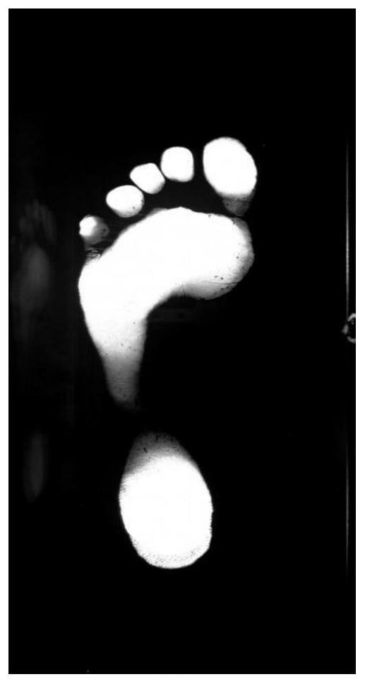 A CNN-based Barefoot Footprint Weight Determination Method