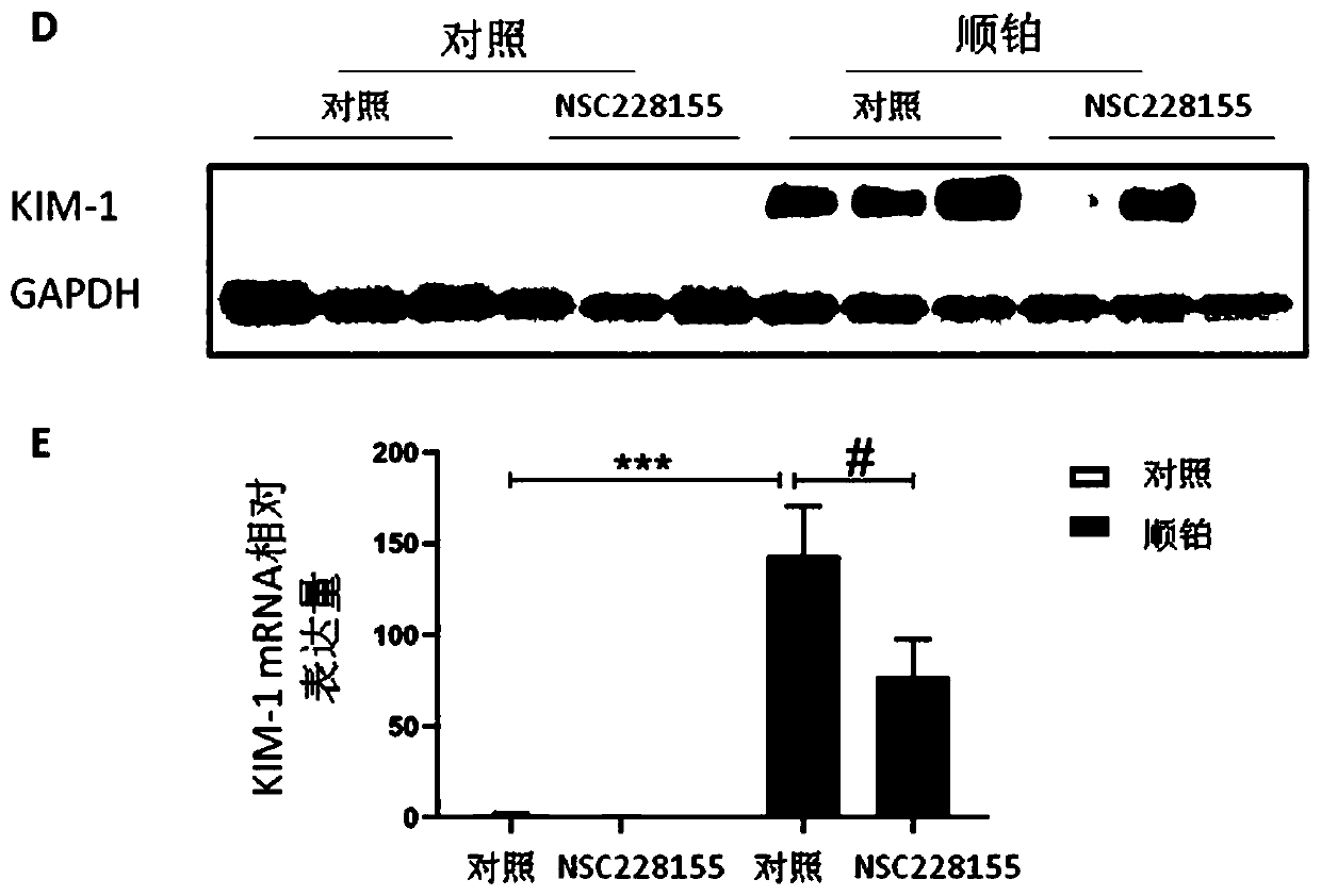 Use of NSC228155 in preparation of medicine for preventing and treating acute kidney injury