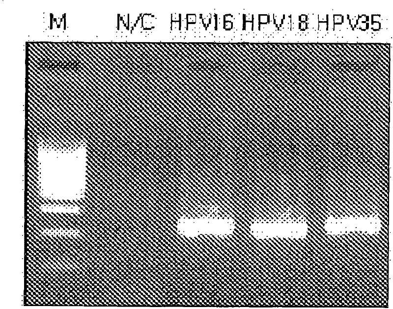 Probe of human papillomavirus and DNA chip comprising the same