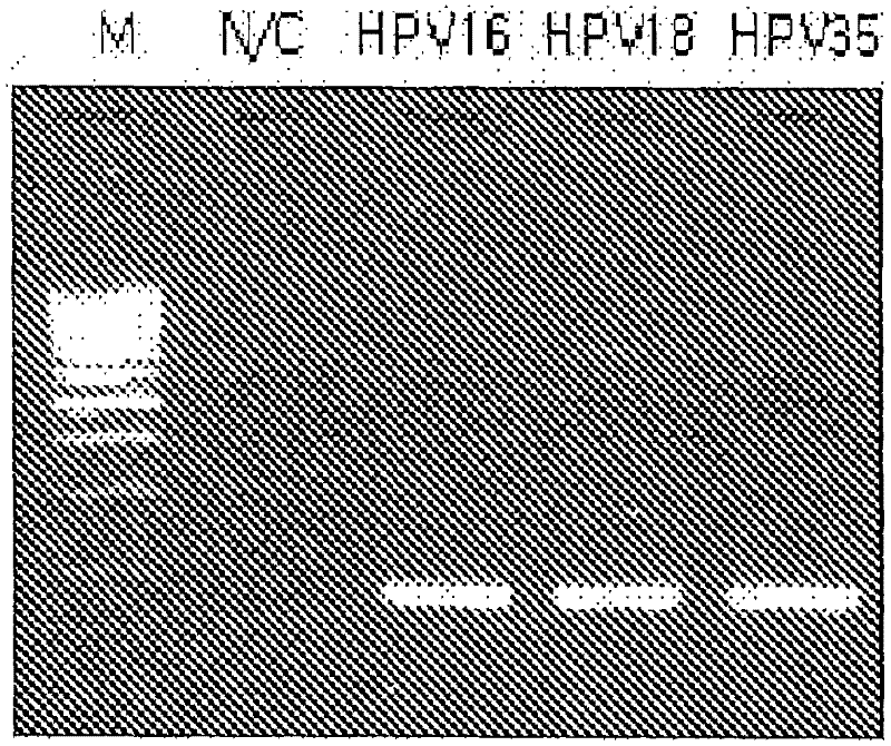 Probe of human papillomavirus and DNA chip comprising the same