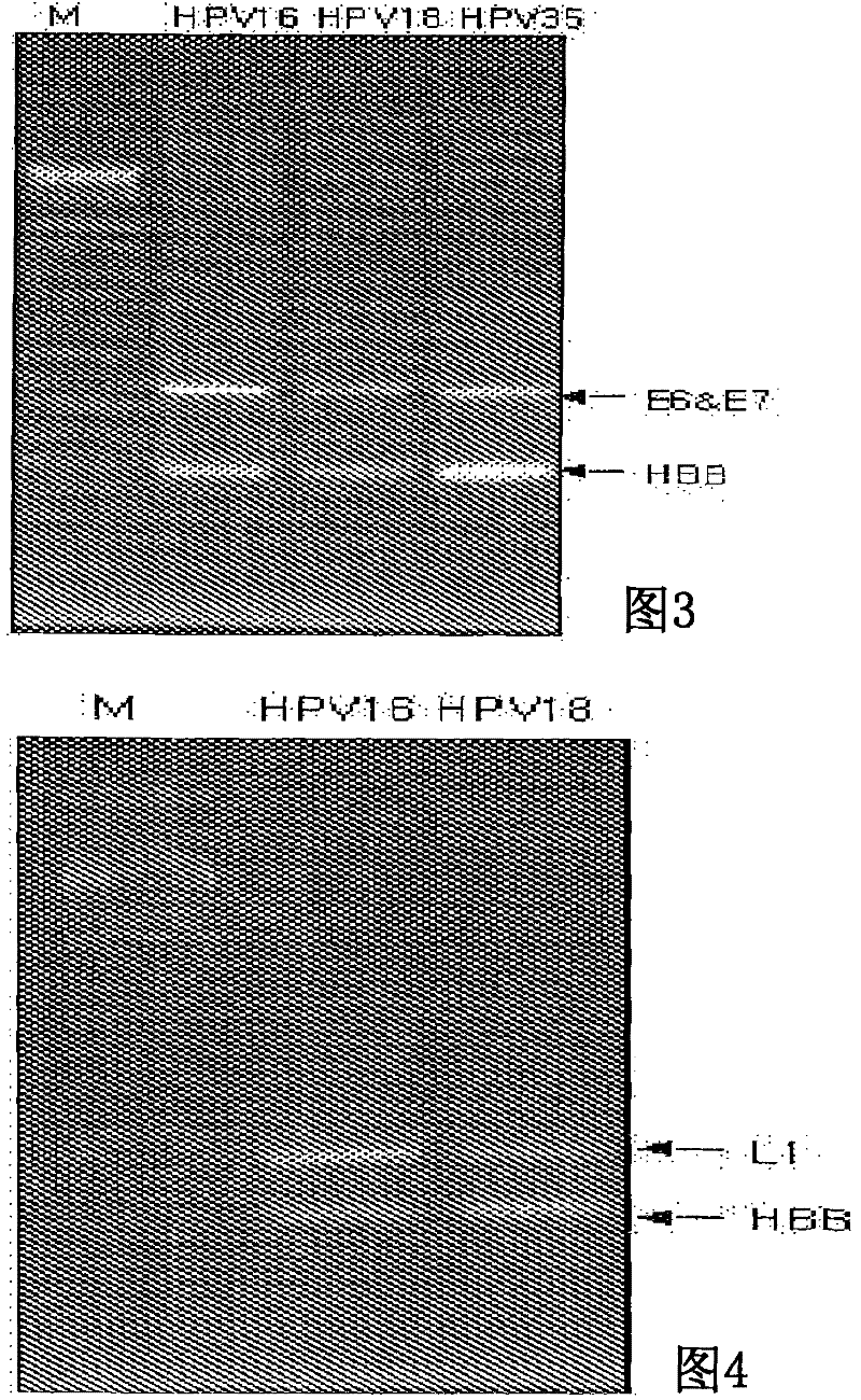 Probe of human papillomavirus and DNA chip comprising the same