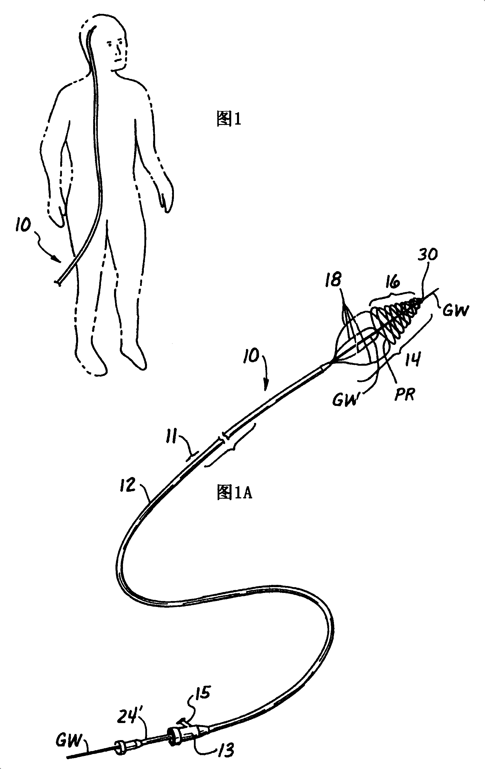 Catheter for excising embolus and treatment method thereof