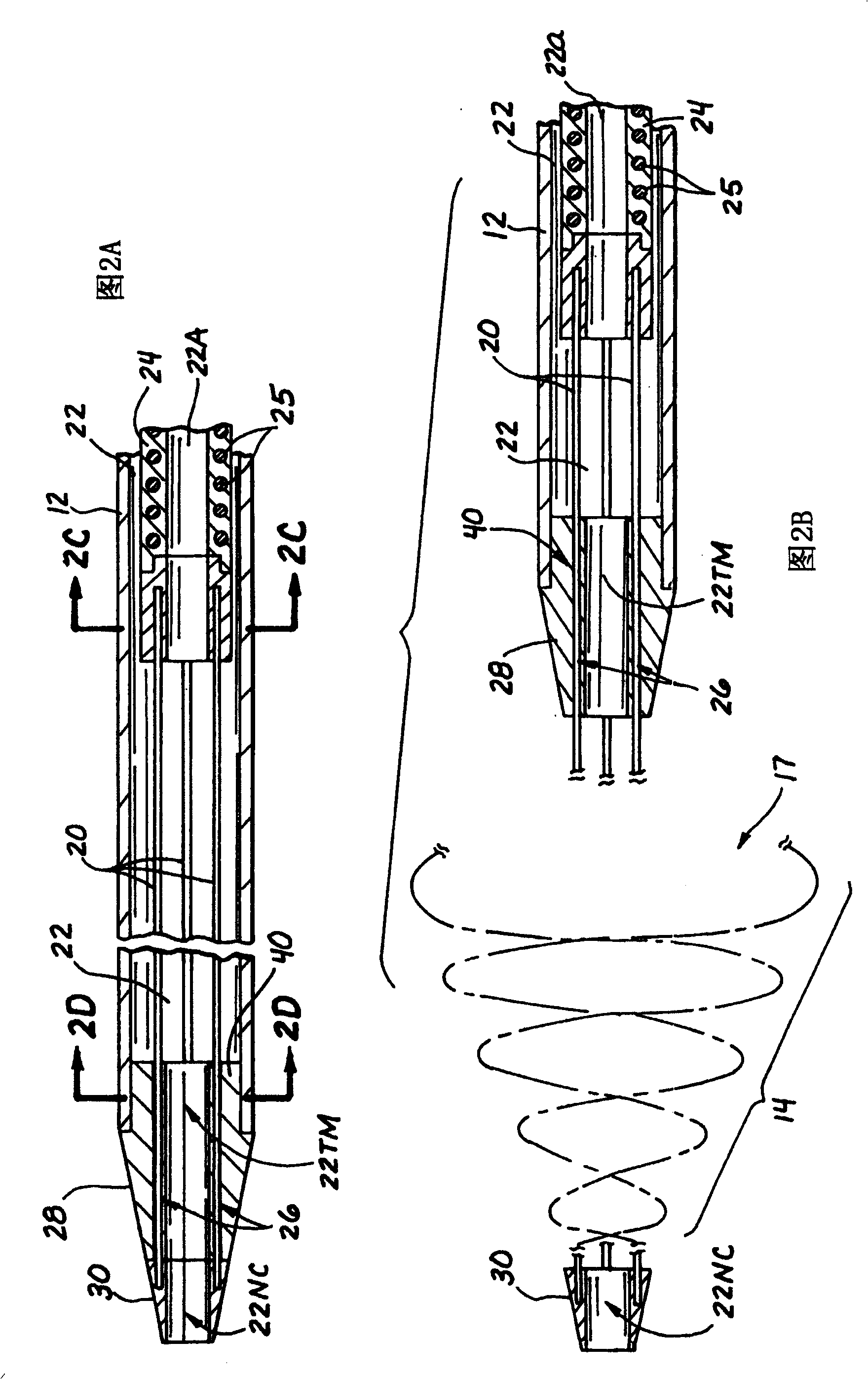 Catheter for excising embolus and treatment method thereof