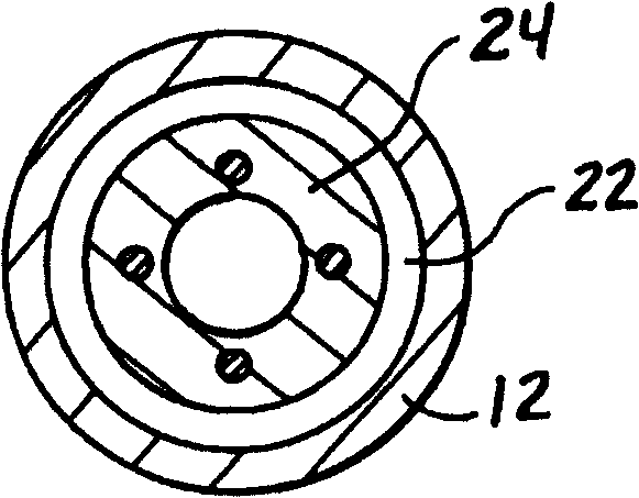 Catheter for excising embolus and treatment method thereof