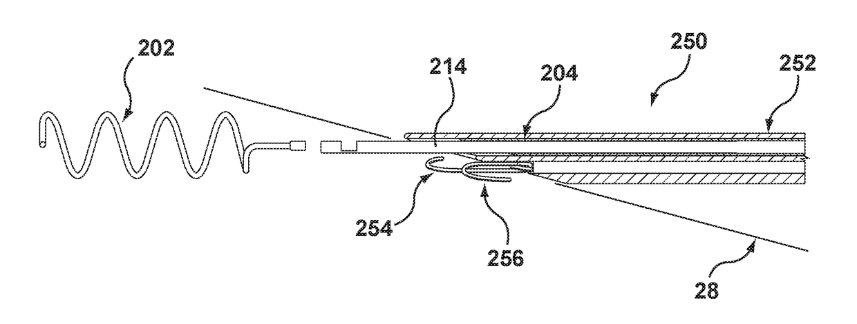 Helical coil mitral valve annuloplasty systems and methods