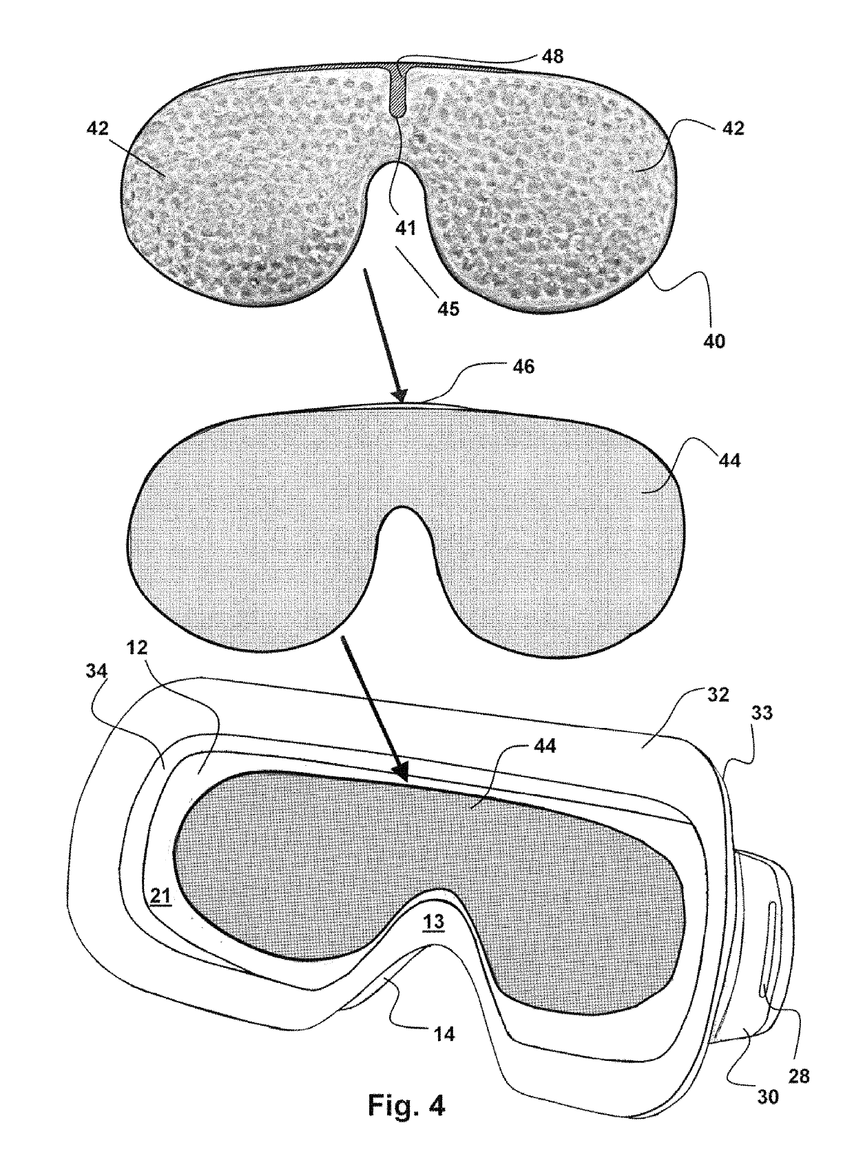 System for treatment of eye conditions