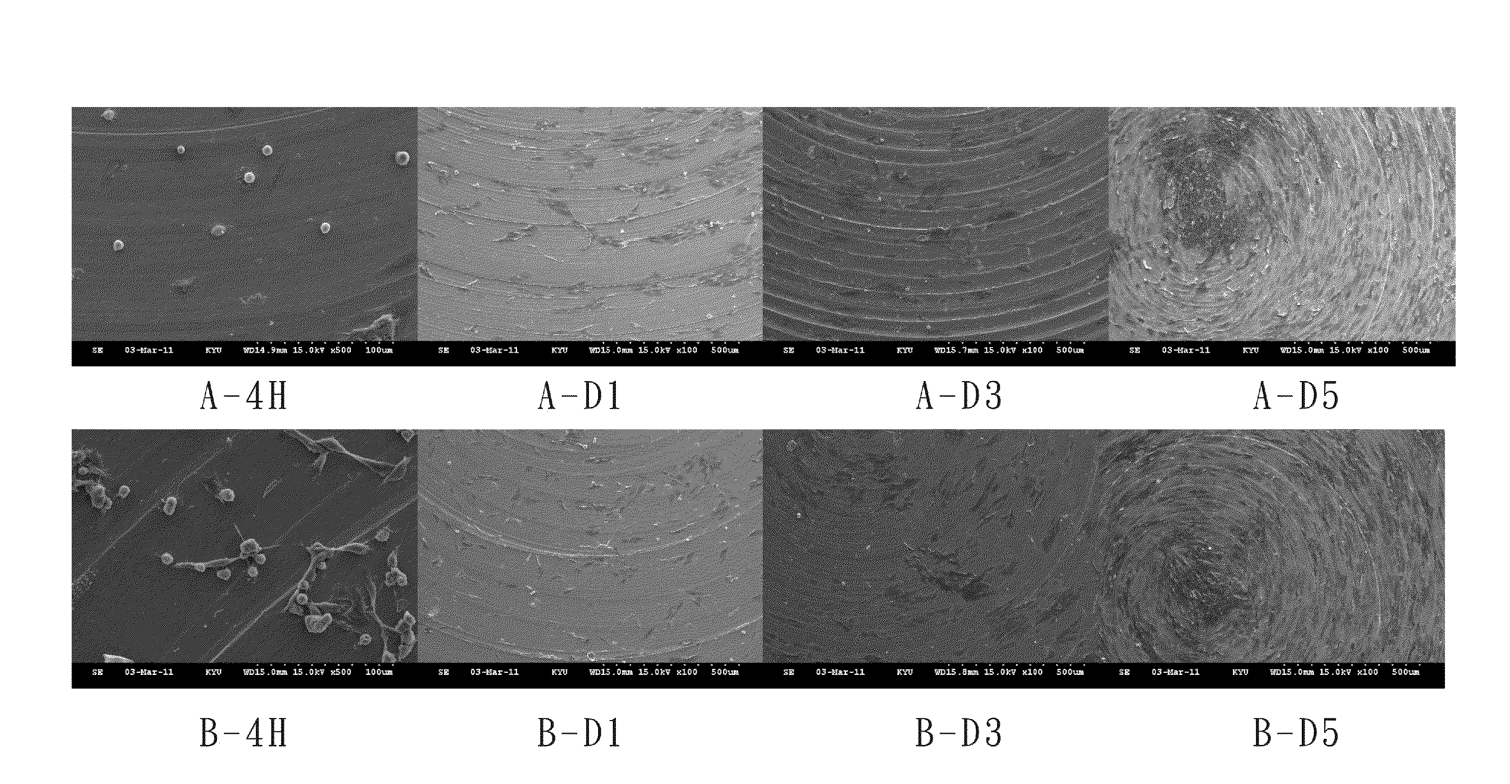 Method for Processing a Surface of a Metal Implant and the Metal Implant Produced by the Method