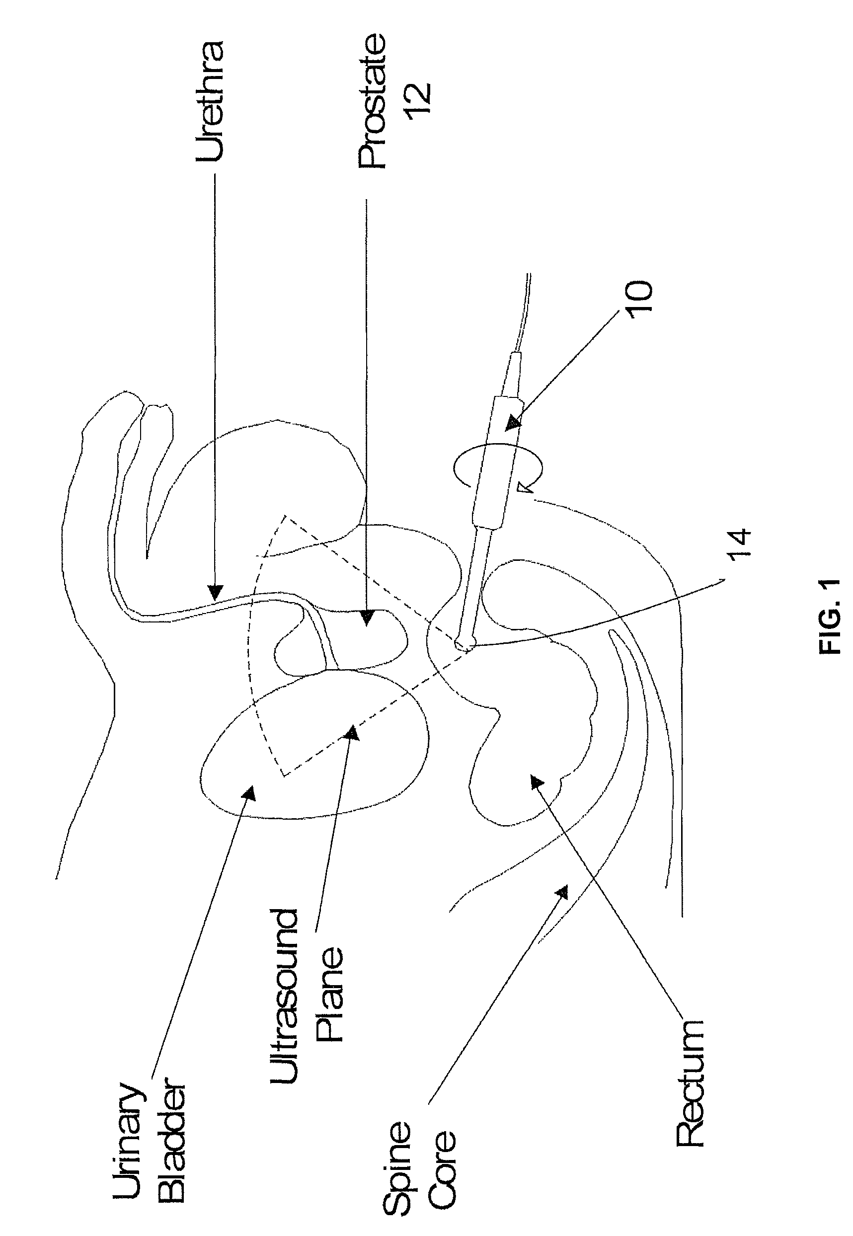 Universal ultrasound holder and rotation device