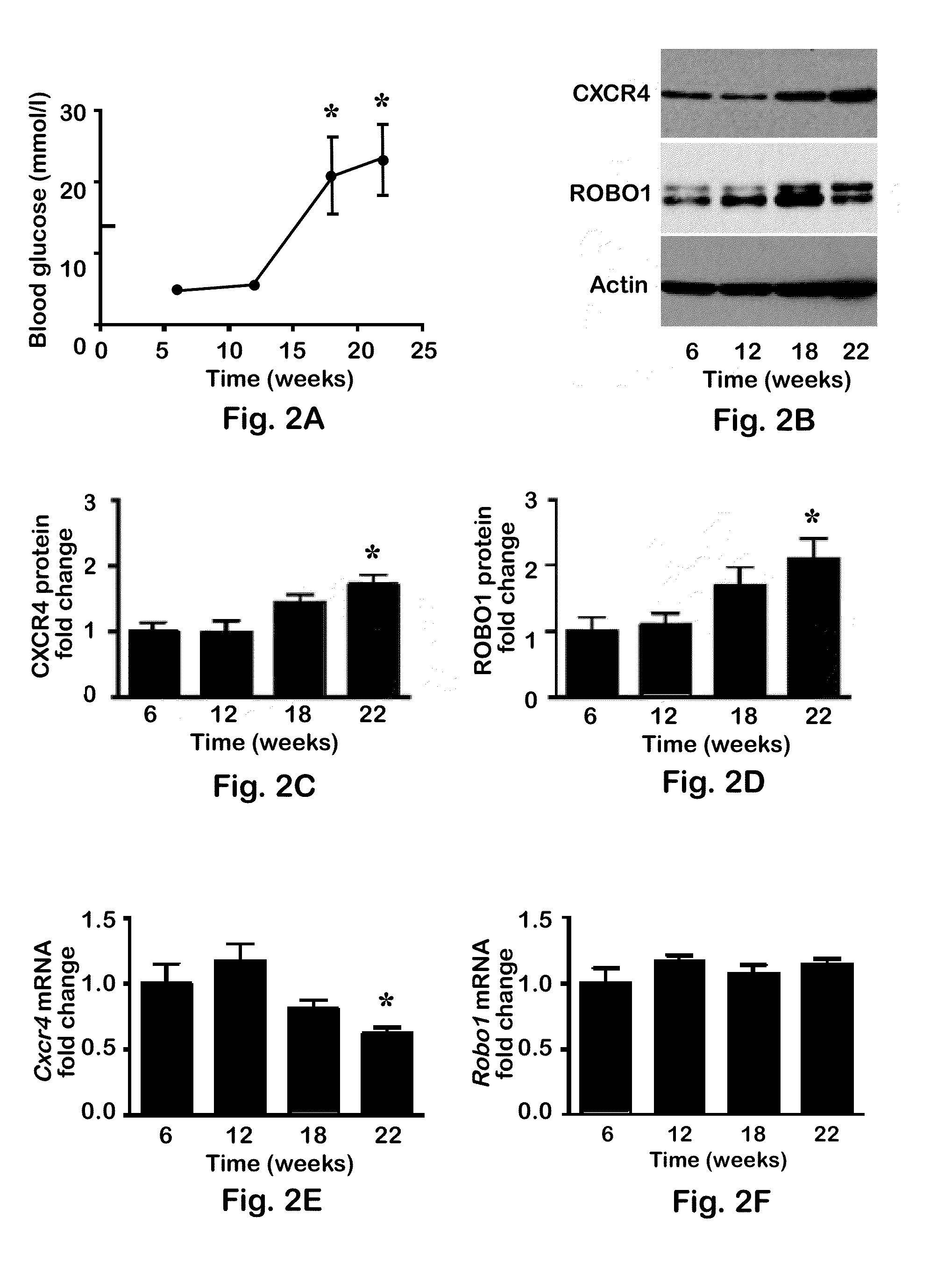 CXCR4 and ROBO1 expression as markers for autoimmune diabetes