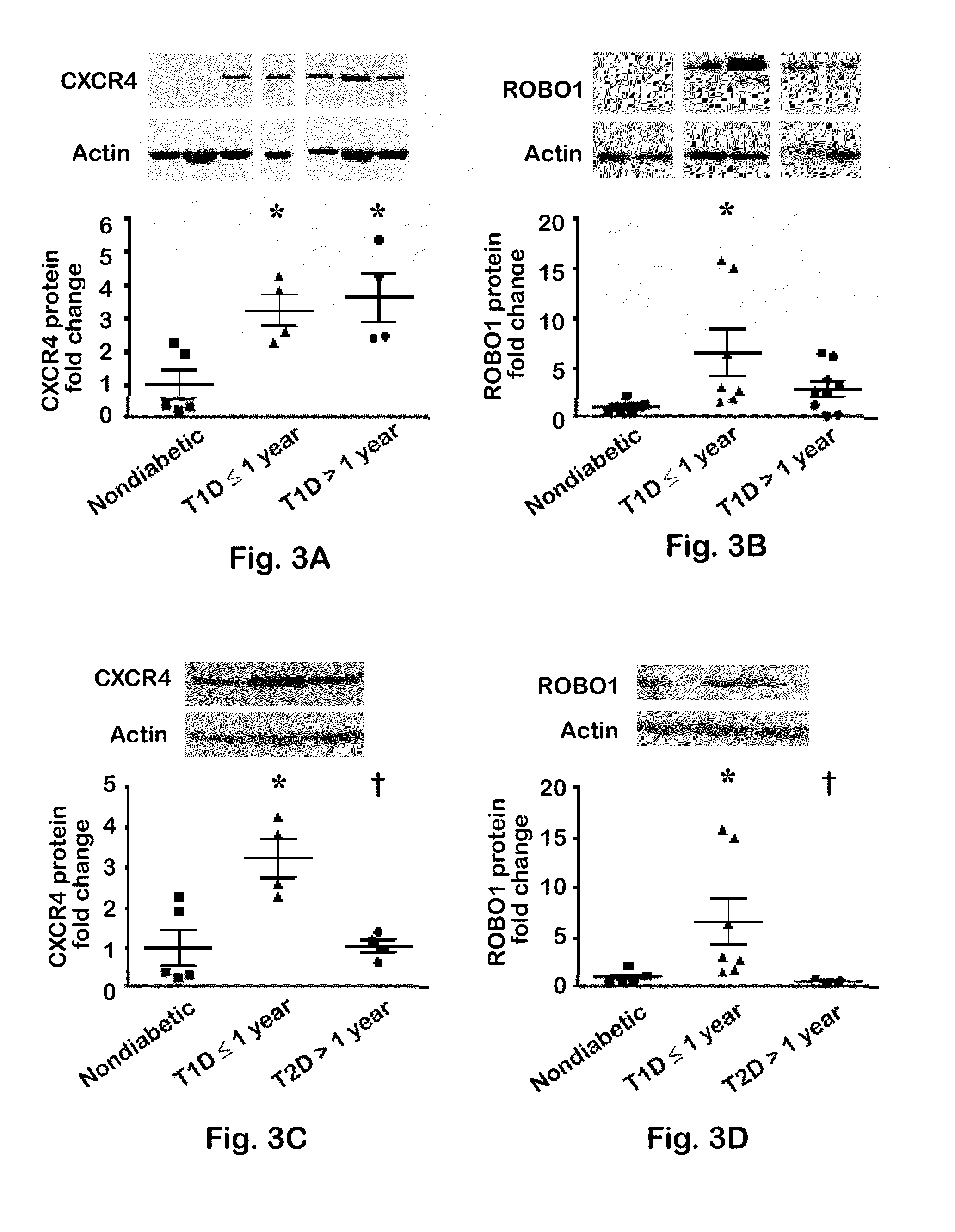 CXCR4 and ROBO1 expression as markers for autoimmune diabetes