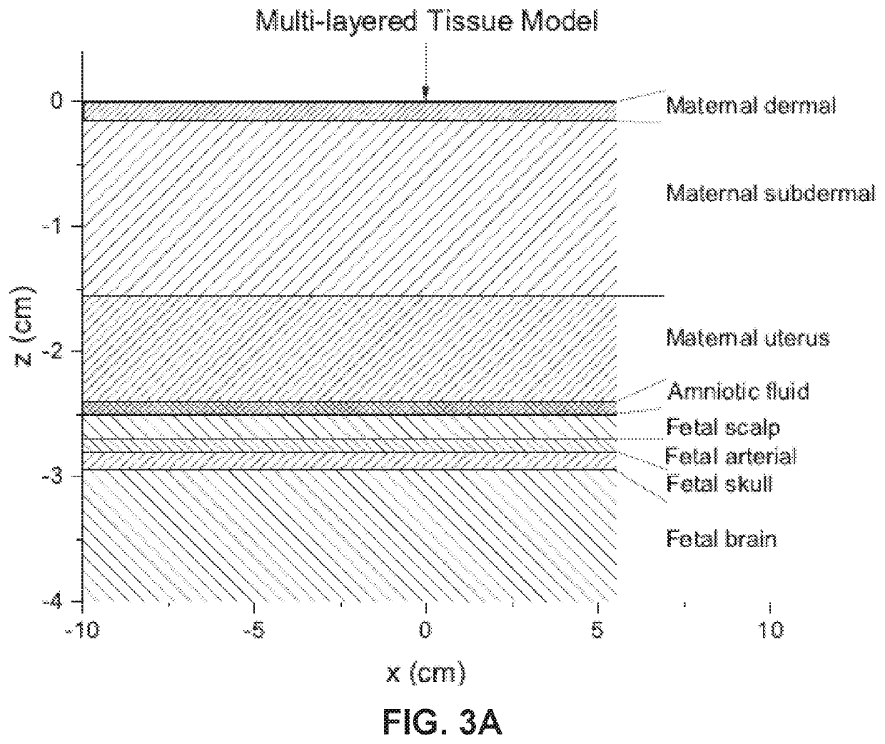 Robust, clinical-grade transabdominal fetal pulse oximetry