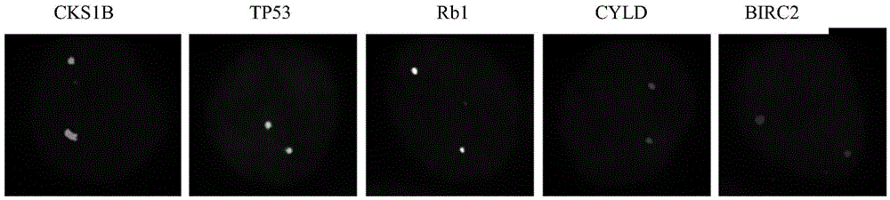 Gene probe composition and kit for detecting clone evolution of multiple myeloma