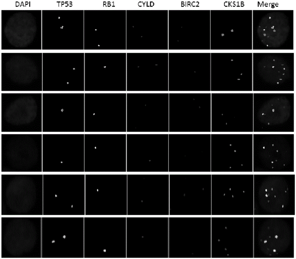 Gene probe composition and kit for detecting clone evolution of multiple myeloma