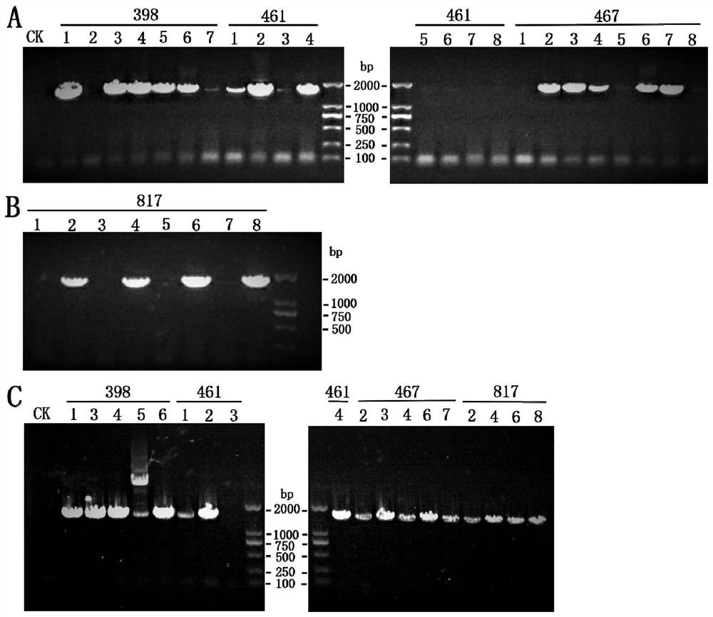 Application of fatty acid elongase gene in yeast synthesis of nervonic acid