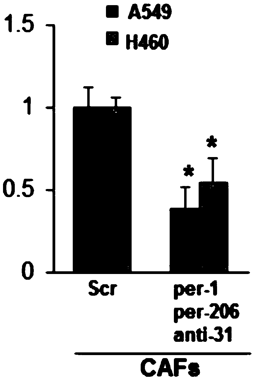 Application of a combination of miRNAs in the preparation of anti-non-small cell lung cancer drugs