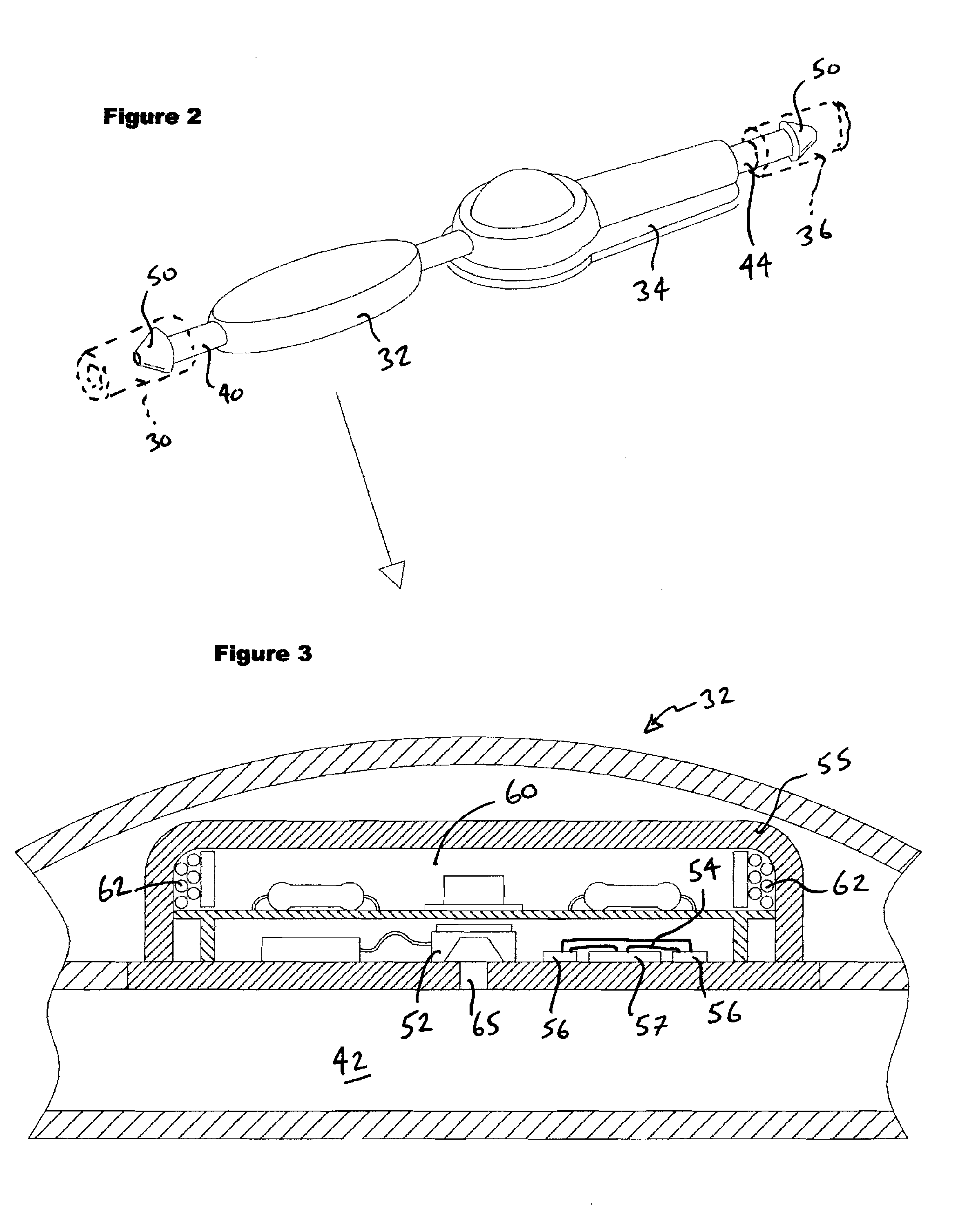 Combined Pressure and Flow Sensor Integrated in a Shunt System