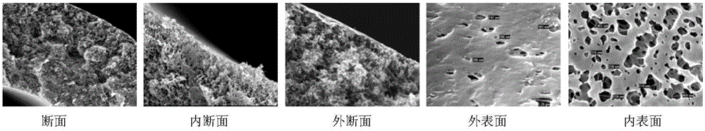 Hollow fiber ultra-filtration membrane preparation method