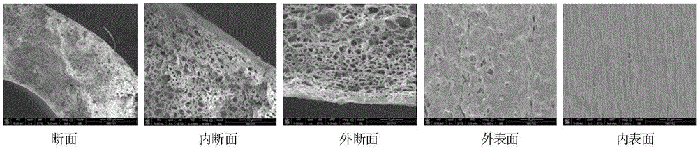 Hollow fiber ultra-filtration membrane preparation method