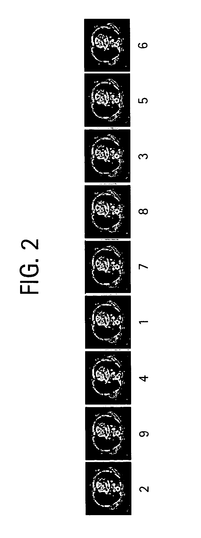 System and method for displaying images on a PACS workstation based on level of significance