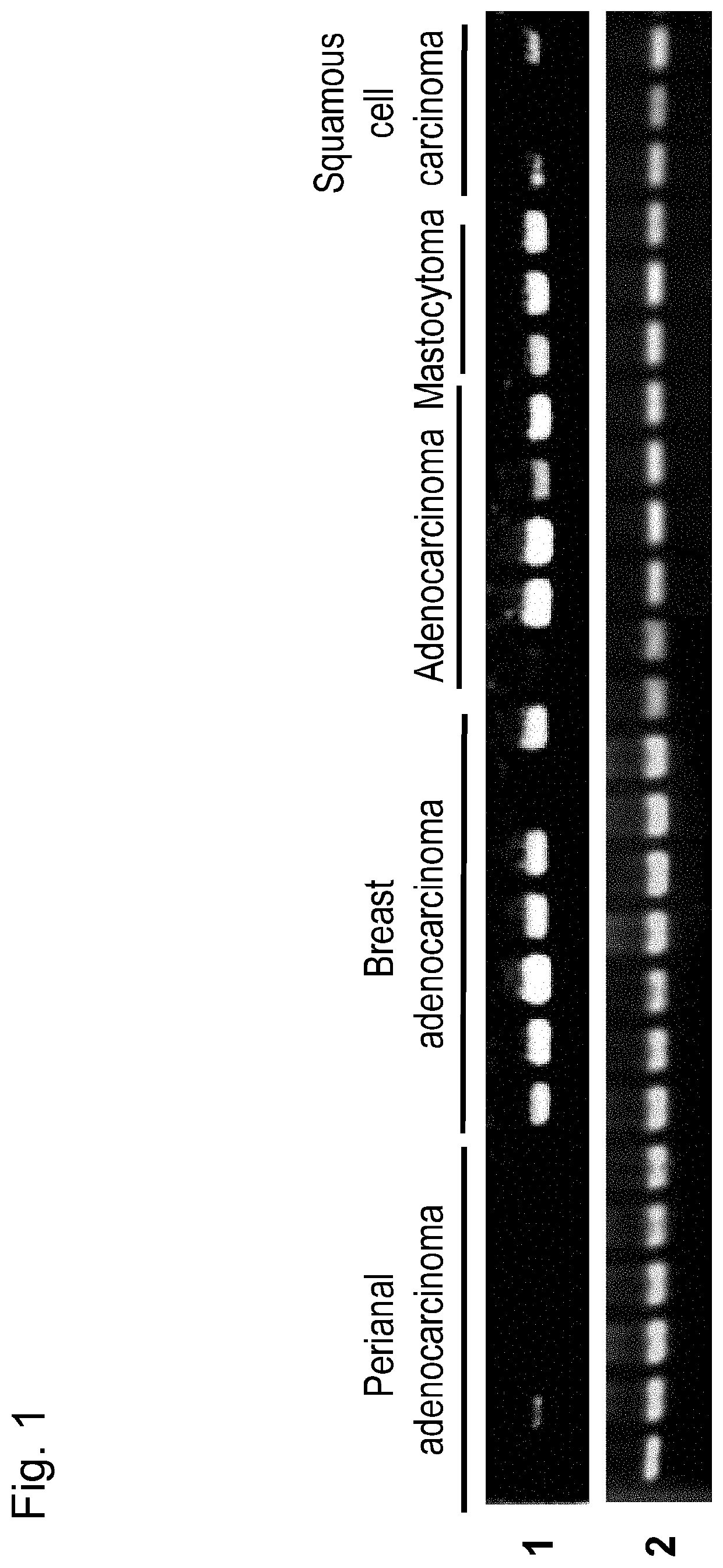Pharmaceutical composition for treating and/or preventing cancer