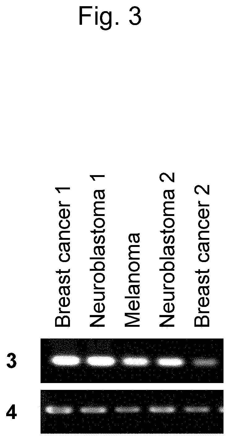 Pharmaceutical composition for treating and/or preventing cancer