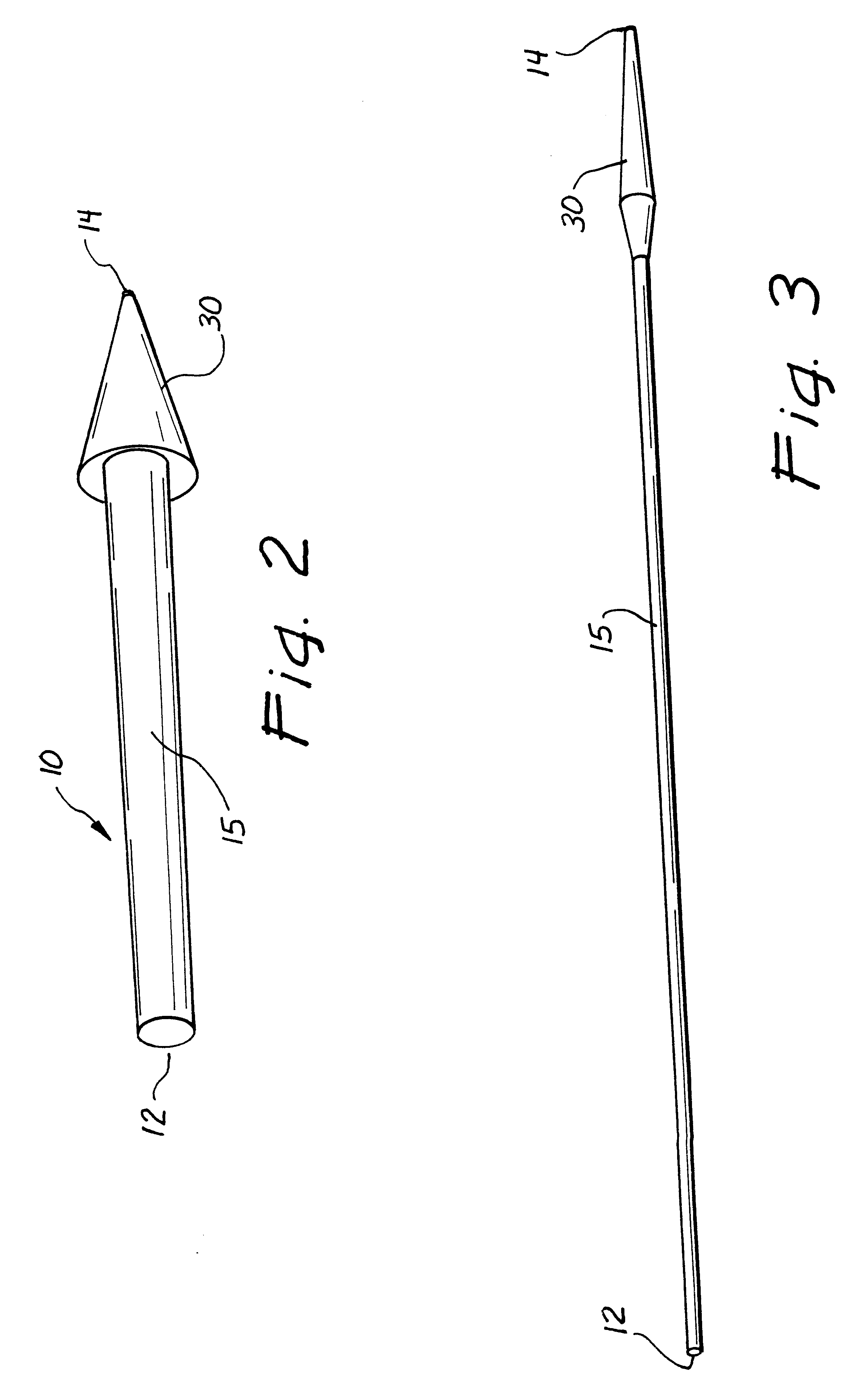 Ureteral stent system apparatus and method