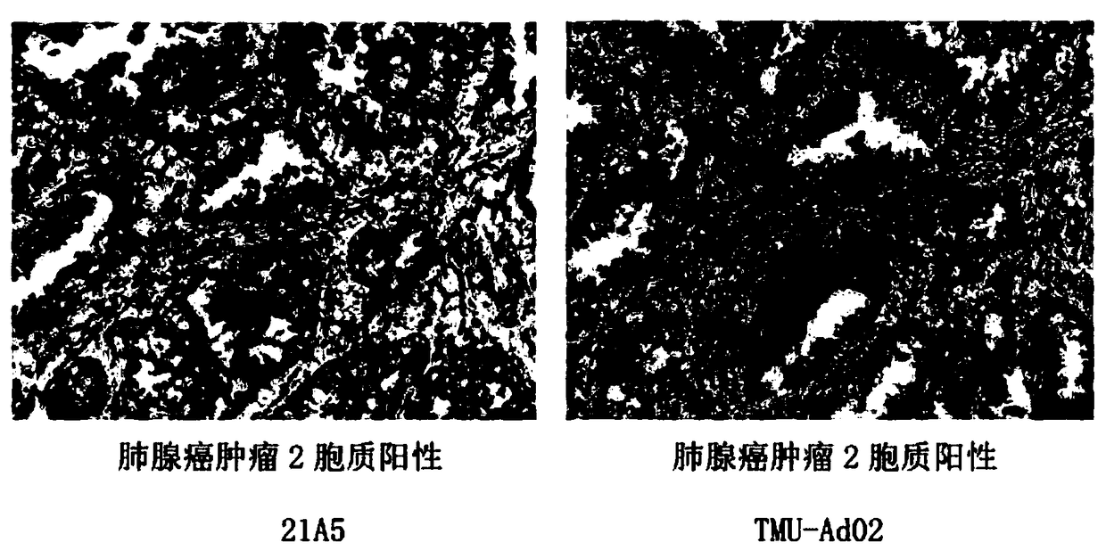 Monoclonal antibody against Napsin A protein, cell strain, preparation method and application