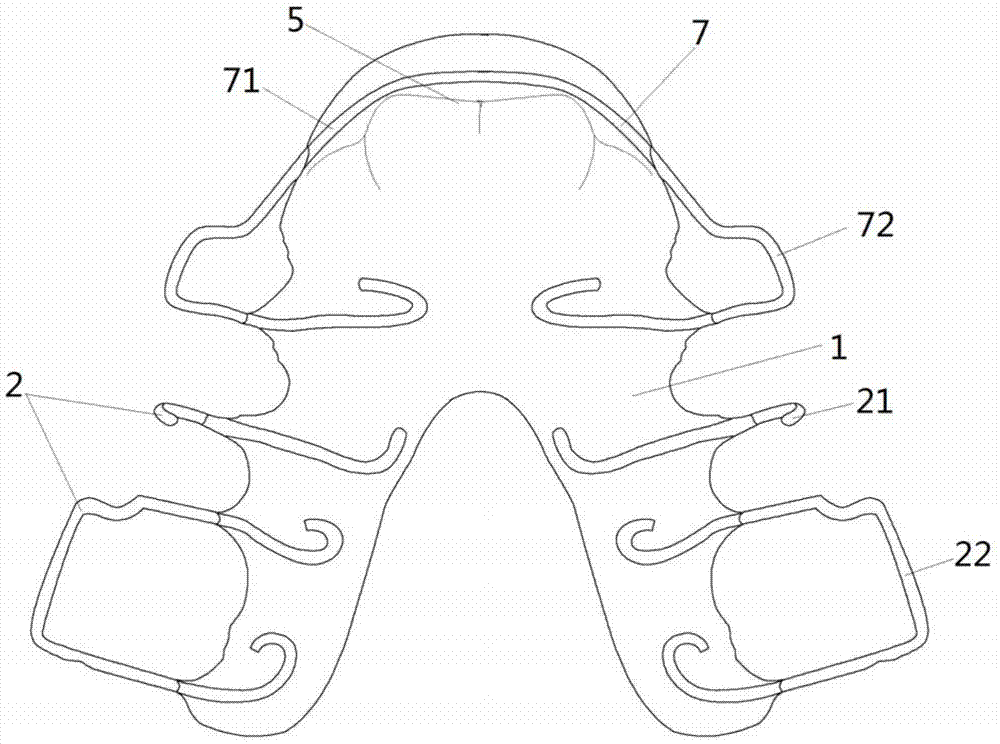 A device for guiding the mandible forward and/or breaking the bad habit of sucking the lower lip and its preparation method