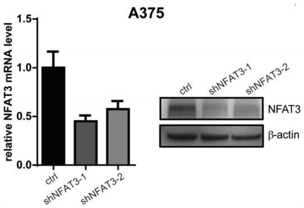 Short hairpin rna, recombinant vector and application for nfat3 gene target