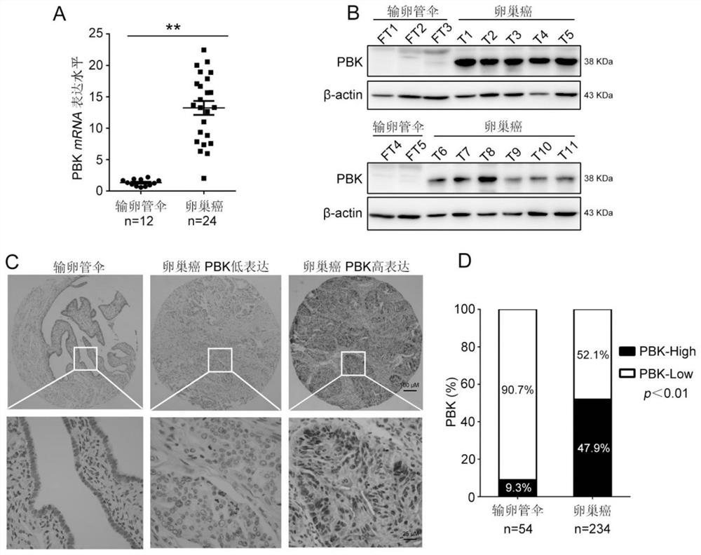 Application of pbk as a target of cisplatin resistance in ovarian cancer