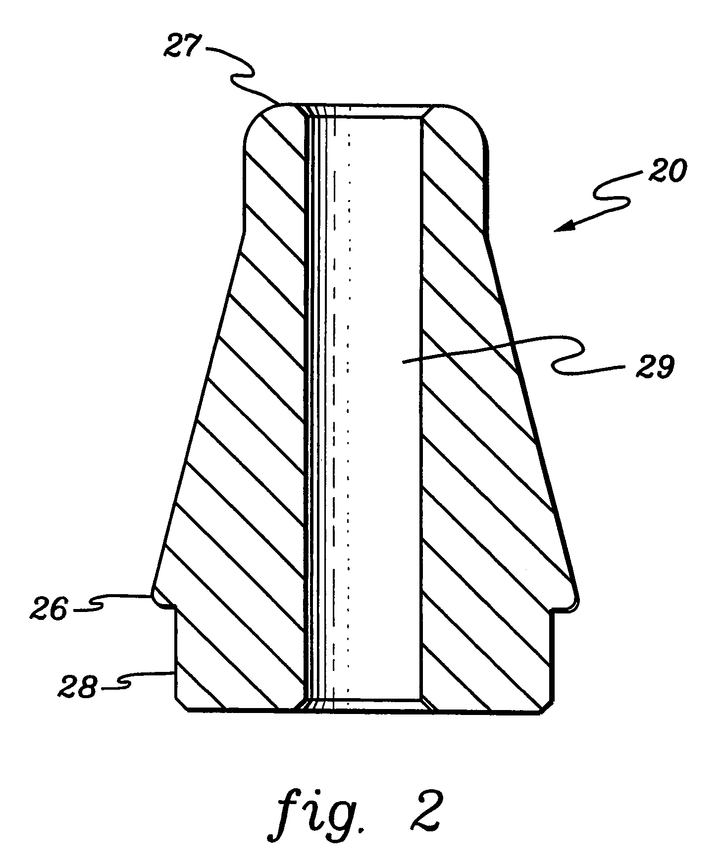 Amniotic membrane covering for a tissue surface and devices facilitating fastening of membranes