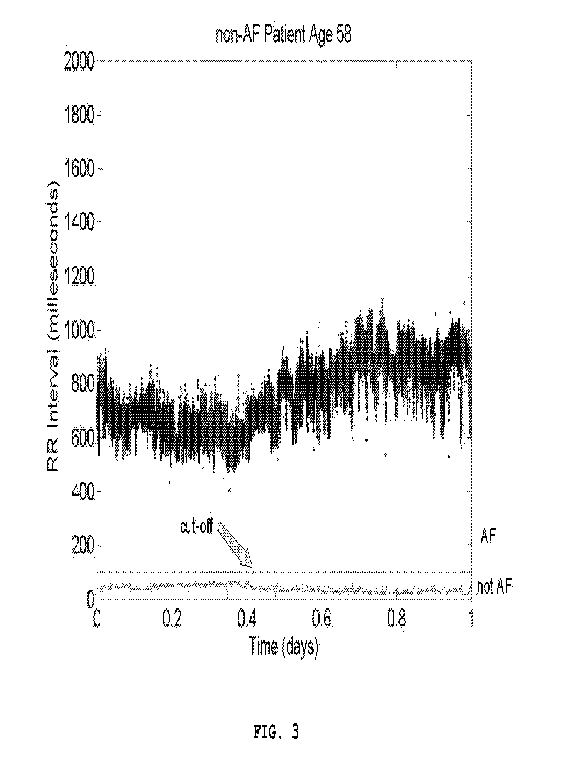 Method, System and Computer Program Product for Non-Invasive Classification of Cardiac Rhythm