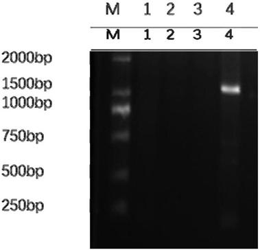 Leucobacterium laccase gene and its recombinant Pichia pastoris engineering strain and application