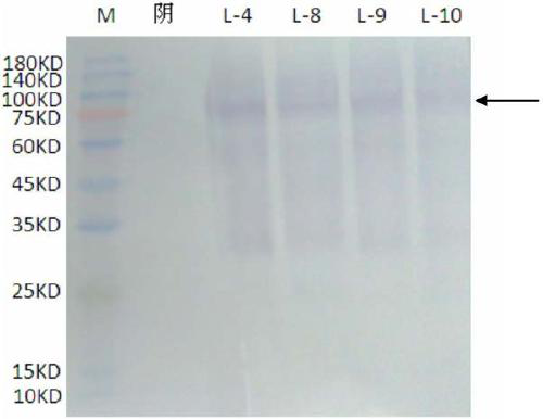 Leucobacterium laccase gene and its recombinant Pichia pastoris engineering strain and application