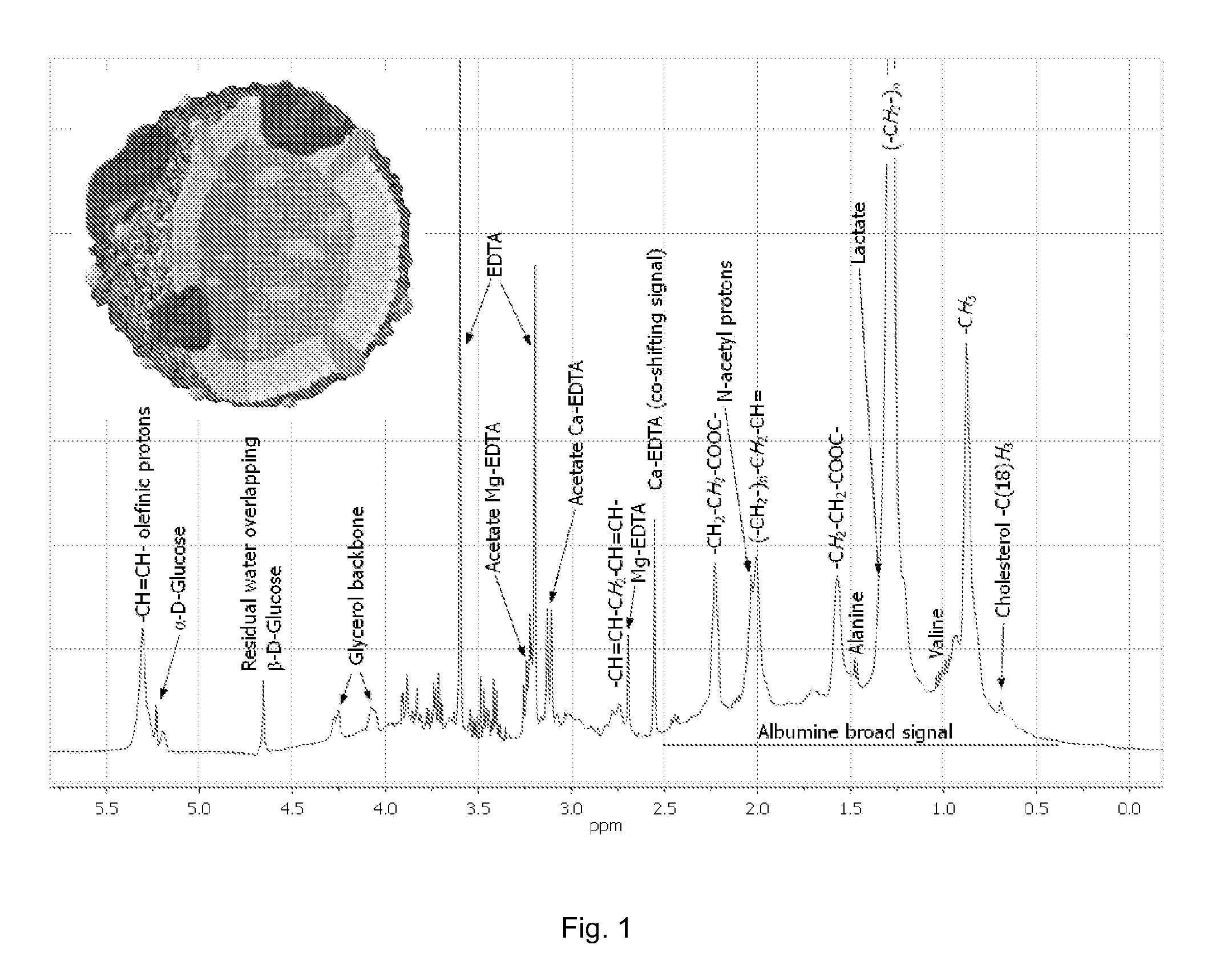 Method for prediction of lipoprotein content from nmr data