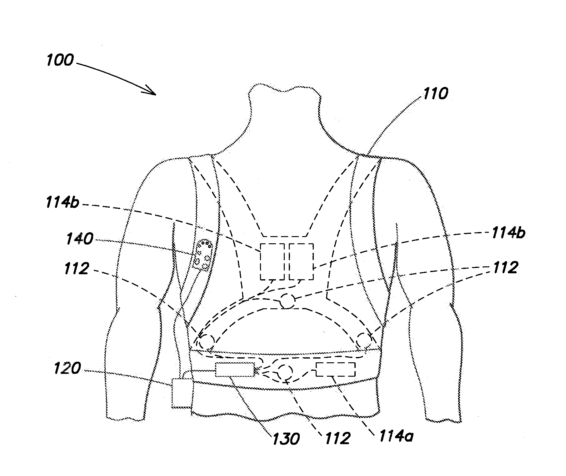 Medical monitoring and treatment device with external pacing