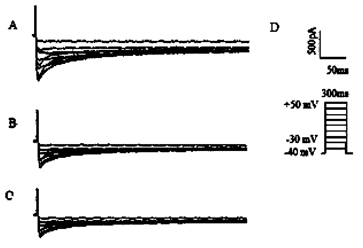 Novel application of Arctigenin in preparation of anti-arrhythmia medicine