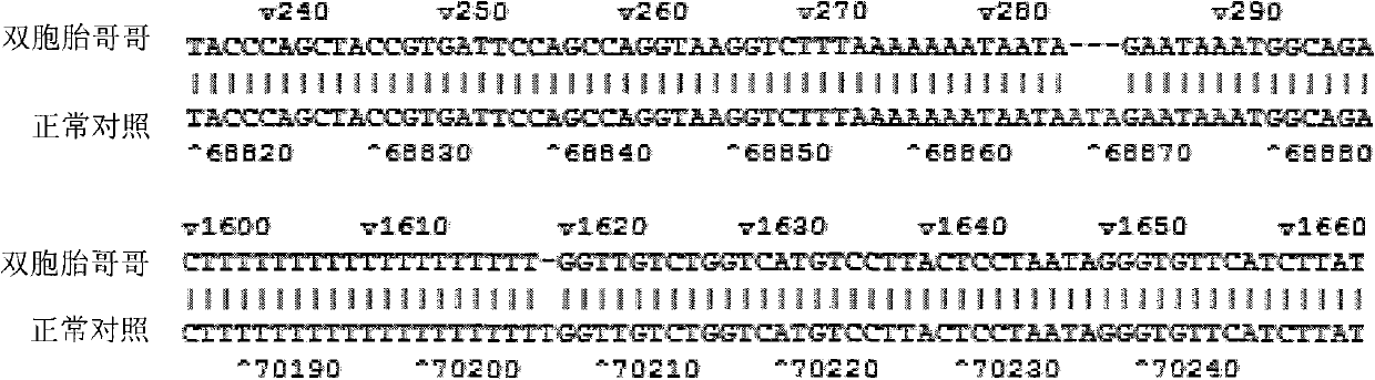 FOXP3 mutator gene of IPEX (immunodysregulation polyendocrinopathy enteropathy X-linked syndrome) syndrome major gene, detection method and kit thereof