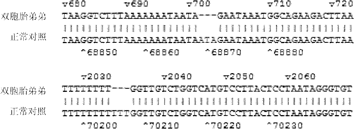 FOXP3 mutator gene of IPEX (immunodysregulation polyendocrinopathy enteropathy X-linked syndrome) syndrome major gene, detection method and kit thereof