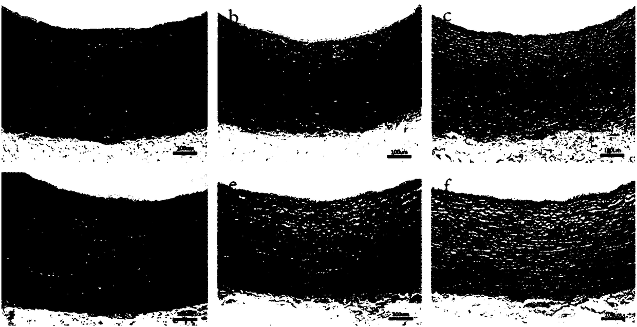 Preparation method of biogenic small-aperture tissue engineering blood vessels