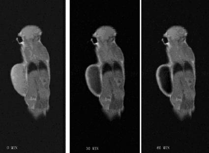 Novel tumor targeting contrast agent