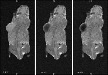 Novel tumor targeting contrast agent