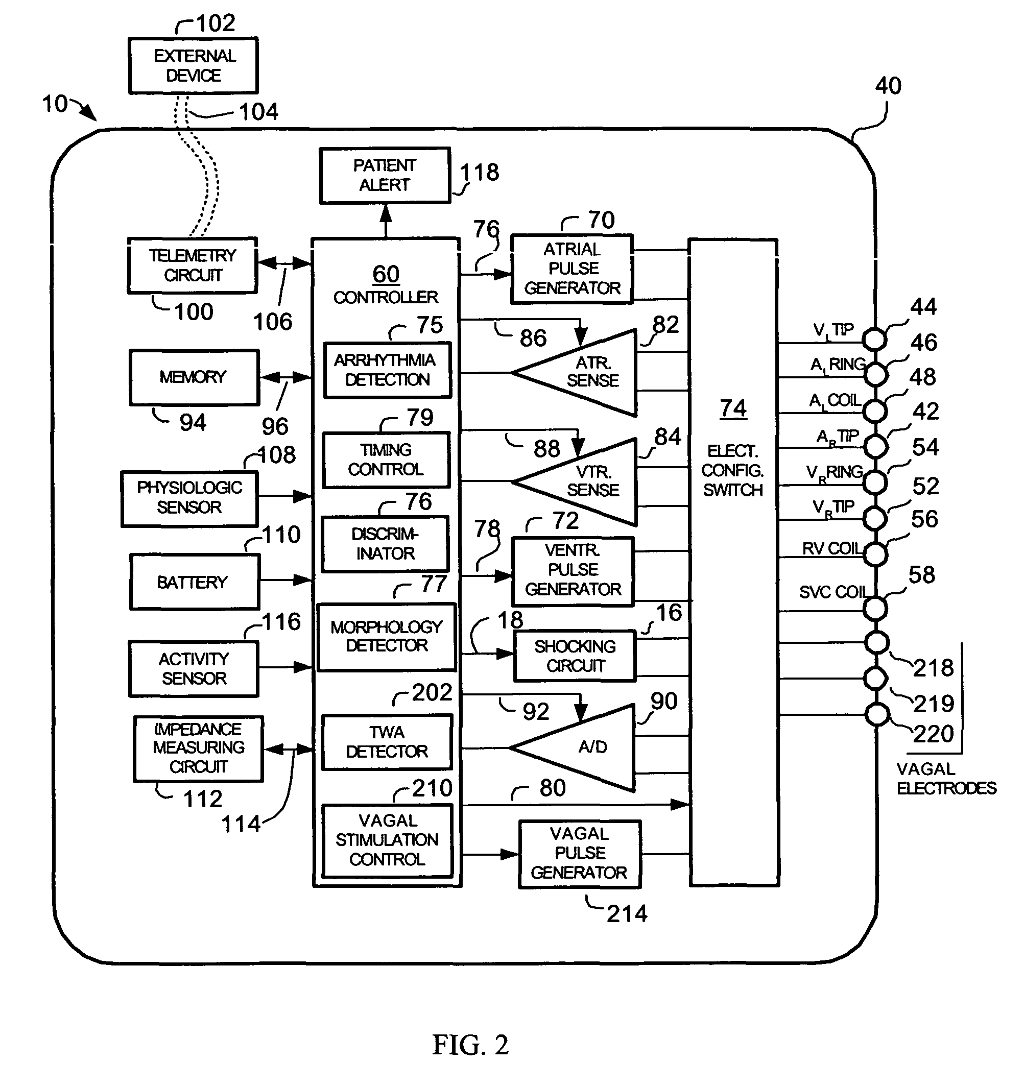 Methods and systems for detecting the presence of T-wave alternans