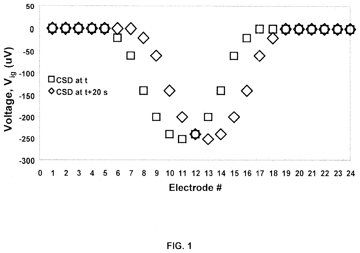 Non-invasive systems and methods to detect cortical spreading depression for the detection and assessment of brain injury and concussion